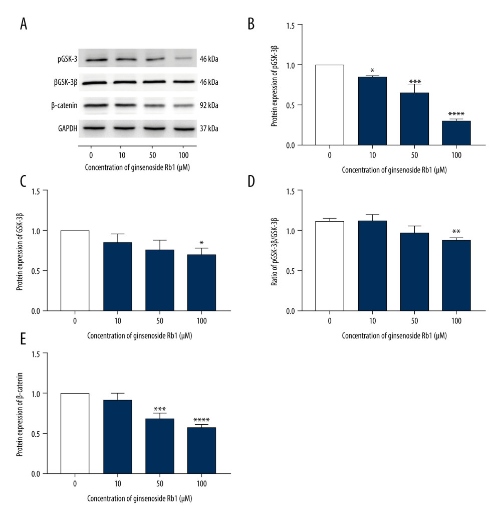 Effect of ginsenoside Rb1 (G-Rb1; 0, 10, 50, and 100 μM) on Wnt/β-catenin signaling. (A) Western blotting results of browning-related genes in 3T3-L1 adipocytes. (B–E) ImageJ quantized the gray value of each protein band. Data are expressed as mean±SD (n=3). * P<0.05, ** P<0.01, *** P<0.001, **** P<0.0001 vs. 0 μM.