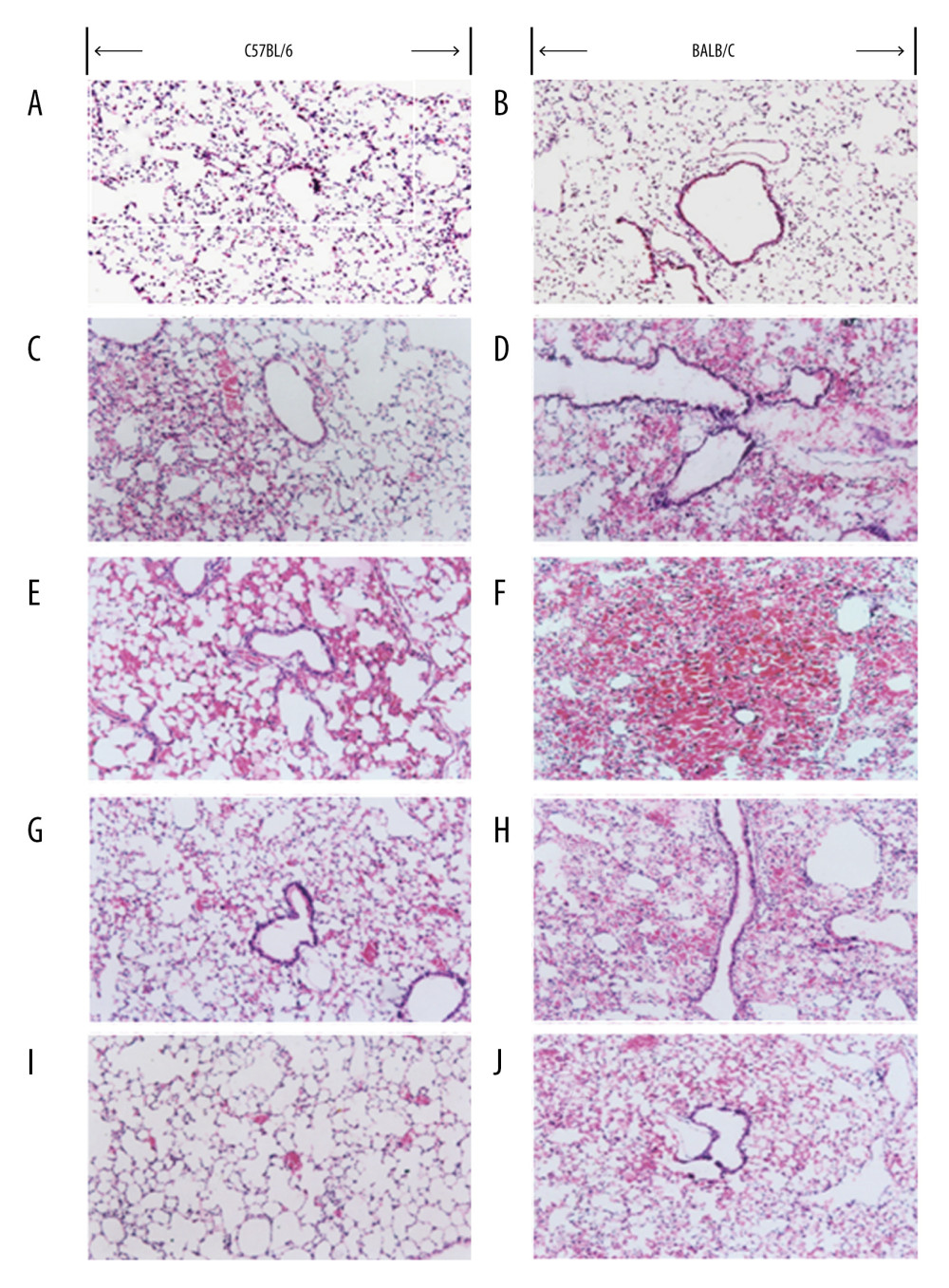 Histopathological changes in C57BL/6 and BALB/C mice before and after systemic blast injury (SBI). Left panels: C57BL/6; right panels: BALB/C. (A, B) before SBI; (C, E, G, I) 1, 6, 24, and 72 h post-SBI, respectively; (D, F, H, J) 1, 6, 24, and 72 h post-SBI respectively. All sections stained with hematoxylin and eosin; magnification, ×100.
