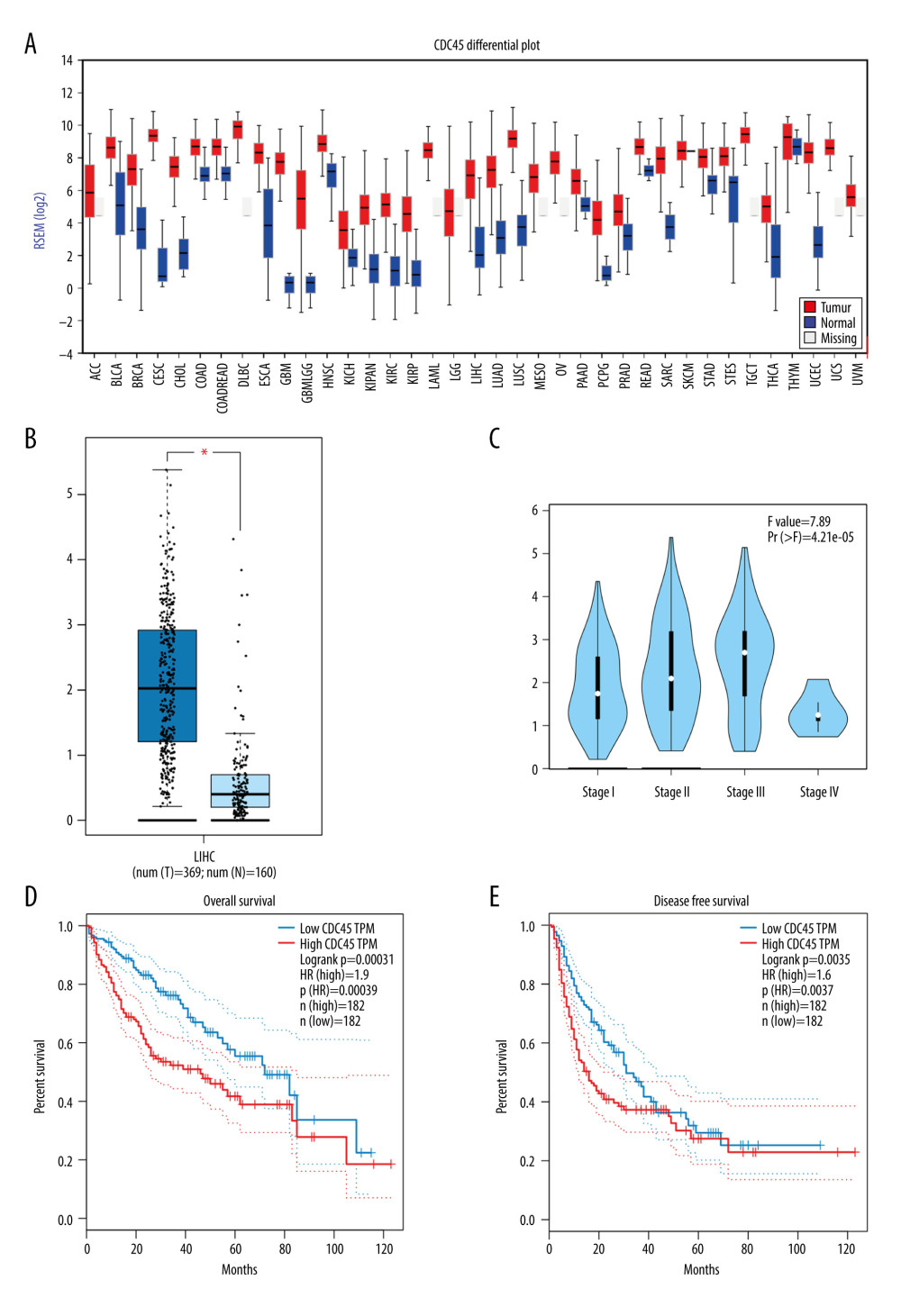 The clinical significance of CDC45 mRNA expression levels in hepatocellular carcinoma (HCC) tissues based on RNA-Seq data. The mRNA expression level of CDC45 was clearly upregulated compared with the controls (A, B). (A) The CDC45 mRNA expression was clearly higher in HCC than in normal tissues. (B) The CDC45 mRNA expression was significantly increased in HCC compared with normal tissues. (C) The CDC45 mRNA expression levels progressively increased from stage I to stage III and decreased in stage IV. A high CDC45 mRNA expression level indicated a negative prognosis (D: for overall survival, HR=1.9, P=0.00039; E: for disease-free survival, HR=1.6, P=0.0037). HR=hazard ratio.