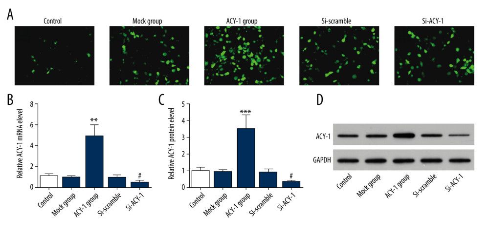 Transfection efficiency of Aminoacylase 1 (ACY-1) in SH-SY5Y cells. (A) ACY-1 expression was determined in SH-SY5Y cells through fluorescence microscopy. (B) ACY-1 mRNA expression was examined through real-time PCR. (C, D) ACY-1 protein expression was determined through western blotting. * Compared to mock group; # compared to siRNA-scramble group.