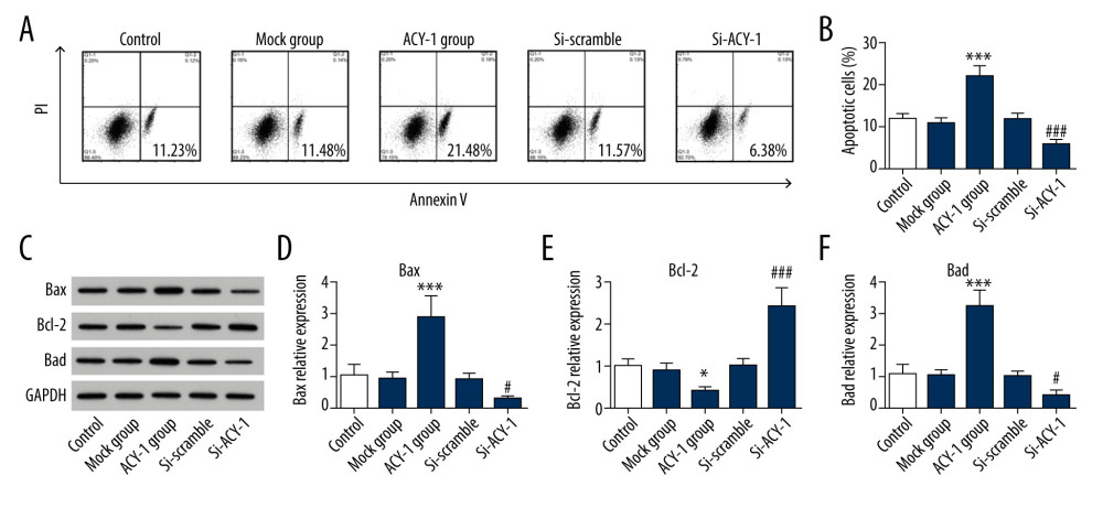 Effect of Aminoacylase 1 (ACY-1) on human neuroblastoma cell apoptosis. (A, B) Flow cytometry was performed to test apoptosis in SH-SY5Y cells. (C–F) The expression of Bax, Bcl-2, and Bad in SH-SY5Y cells were detected using western blotting. * Compared to mock group; # compared to siRNA-scramble group.
