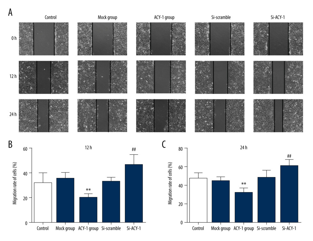 Influence of Aminoacylase 1 (ACY-1) on the migration of SH-SY5Y cells determined by wound healing assay. (A–C) SH-SY5Y cells were scraped off with pipette tips and cultured for 0, 12, and 24 h. Cell migration was determined under a microscope before and after injury. * Compared to mock group; # compared to siRNA-scramble group.