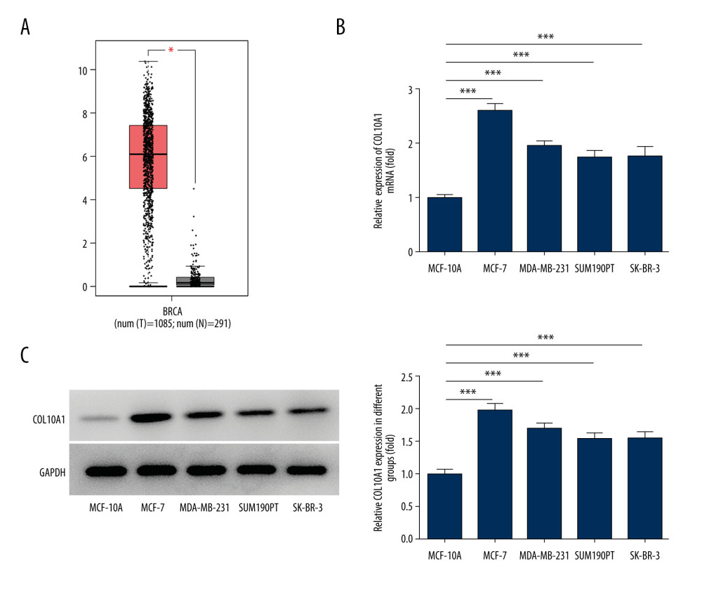 COL10A1 was greatly elevated in breast cancer. (A) COL10A1 expression in tumor tissues or normal tissues of breast cancer patients was analyzed based on GEPIA repository (http://gepia.cancer-pku.cn/). (B) RT-qPCR analysis of COL10A1 expression in human breast epithelial cells (MCF-10A) and breast cancer cell lines (MCF-7, MDA-MB-231, SUM190PT, SK-BR-3). (C) Western blot analysis of COL10A1 expression in human breast epithelial cells (MCF-10A) and breast cancer cell lines (MCF-7, MDA-MB-231, SUM190PT, SK-BR-3). *** P<0.001.