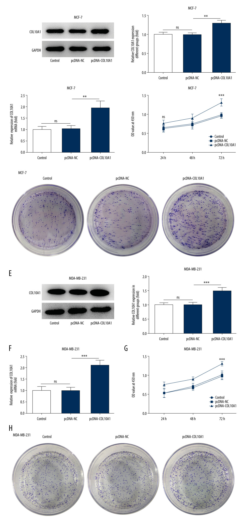 Upregulation of COL10A1 enhanced cell proliferation and clone-forming abilities of breast cancer cells. (A) Western blot analysis was performed to detect the transfection efficiency in MCF-7 cells which were transfected with pcDNA-COL10A1. (B) RT-qPCR analysis was performed to detect the transfection efficiency in MCF-7 cells which were transfected with pcDNA-COL10A1. (C) CCK-8 assay was applied to explore the effect of COL10A1 overexpression on cell viability of MCF-7. (D) Colony formation assay was applied to explore the effect of COL10A1 overexpression on clone-forming ability of MCF-7. (E) Western blot analysis was performed to detect the transfection efficiency in MDA-MB-231 cells which were transfected with pcDNA-COL10A1. (F) RT-qPCR analysis was performed to detect the transfection efficiency in MDA-MB-231 cells which were transfected with pcDNA-COL10A1. (G) CCK-8 assay was applied to explore the effect of COL10A1 overexpression on cell viability of MDA-MB-231. (H) Colony formation assay was applied to explore the effect of COL10A1 overexpression on clone-forming ability of MDA-MB-231. * P<0.05, ** P<0.01, *** P<0.001.
