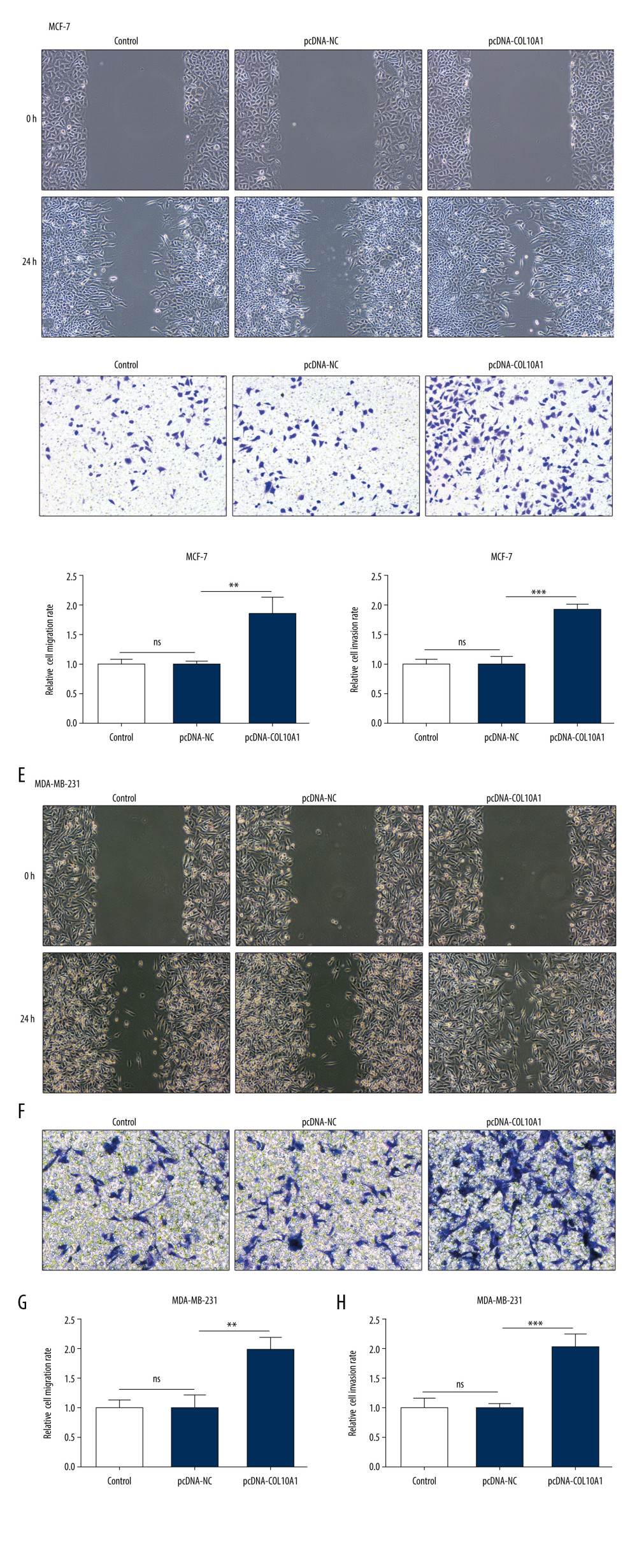 Upregulation of COL10A1 boosted the migration and invasion of breast cancer cells. (A, C). Wound healing assay was used to examine the effect of COL10A1 overexpression on MCF-7 cell migration (100×). (B, D). Transwell assay was used to examine the effect of COL10A1 overexpression on MCF-7 cell invasion (100×). (E, G). Wound healing assay was used to examine the effect of COL10A1 overexpression on MDA-MB-231 cell migration (100×). (F, H). Transwell assay was used to examine the effect of COL10A1 overexpression on MDA-MB-231 cell invasion (100X). ** P<0.01, *** P<0.001.