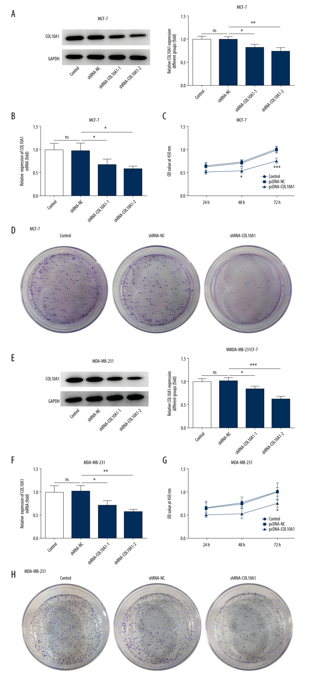 Downregulation of COL10A1 suppressed cell proliferation and clone-forming abilities of breast cancer cells. (A) Western blot analysis was performed to detect the transfection efficiency in MCF-7 cells which were transfected with shRNA-COL10A1-1 or shRNA-COL10A1-2. (B) RT-qPCR analysis was performed to detect the transfection efficiency in MCF-7 cells which were transfected with shRNA-COL10A1-1 or shRNA-COL10A1-2. (C) CCK-8 assay was applied to explore the effect of silenced COL10A1 on cell viability of MCF-7. (D) Colony formation assay was applied to explore the effect of silenced COL10A1 on clone-forming ability of MCF-7. (E) Western blot analysis was performed to detect the transfection efficiency in MDA-MB-231 cells which were transfected with shRNA-COL10A1-1 or shRNA-COL10A1-2. (F) RT-qPCR analysis was performed to detect the transfection efficiency in MDA-MB-231 cells which were transfected with shRNA-COL10A1-1 or shRNA-COL10A1-2. (G) CCK-8 assay was applied to explore the effect of silenced COL10A1 on cell viability of MDA-MB-231. (H). Colony formation assay was used to explore the effect of silenced COL10A1 on clone-forming ability of MDA-MB-231. * P<0.05, ** P<0.01, *** P<0.001.