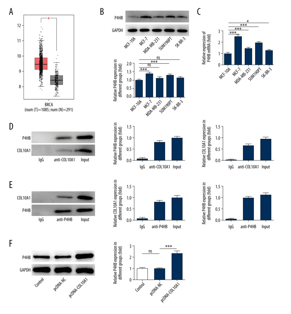COL10A1 combined with P4HB. (A) P4HB expression in tumor tissues or normal tissues of breast cancer patients was analyzed based on GEPIA repository (http://gepia.cancer-pku.cn/). (B) Western blot analysis of P4HB expression in human breast epithelial cells (MCF-10A) and breast cancer cell lines (MCF-7, MDA-MB-231, SUM190PT, SK-BR-3). (C) RT-qPCR analysis of P4HB expression in human breast epithelial cells (MCF-10A) and breast cancer cell lines (MCF-7, MDA-MB-231, SUM190PT, SK-BR-3). (D, E) The relation between COL10A1 and P4HB was determined by Co-IP assay. (F) Western blot analysis of P4HB expression after transfection with pcDNA-COL10A1. * P<0.05, *** P<0.001.