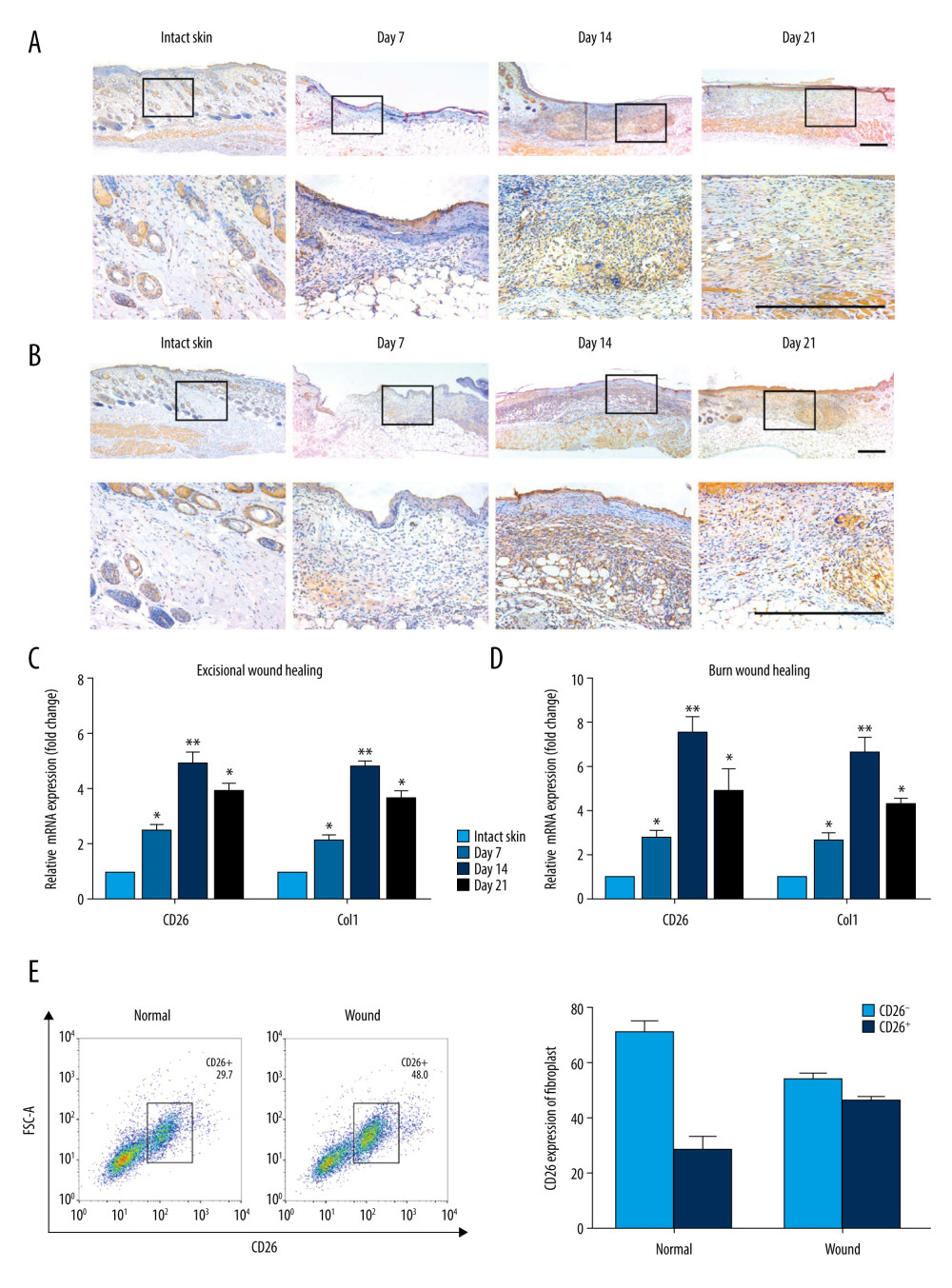Patterns of CD26 Expression in Intact Normal Skin and Skin Wound Models. (A) Immunohistochemical staining of CD26 in samples of excisional wounds on days 7, 14 and 21. The lower panel corresponds to the high magnification area in the upper panel. (B) Immunohistochemical staining of CD26 in burn wound samples on days 7, 14, and 21. The lower panel corresponds to the high magnification area in the upper panel. (C) The mRNA expression levels of CD26 and Col1 were significantly increased in samples of skin excisional wounds compared with normal skin (n=5). (D) The mRNA expression levels of CD26 and Col1 were significantly increased in burn wound samples compared with normal skin (n=5). (E) The proportion of CD26+ fibroblasts was significantly higher in WFs than in NFs (detected by FACS and its quantification) (n=5). Scale bar: 200 μm, t test, * P<0.05 vs Intact skin group, ** P<0.01 vs Intact skin group.