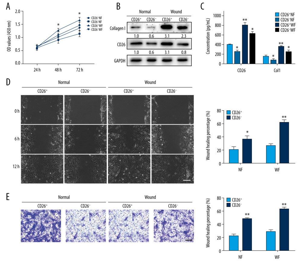 CD26 promotes cell proliferation, migration, and collagen biosynthesis in vitro. (A) Cell proliferation was remarkably increased in CD26+ WFs (CCK-8 viability assay). (B) The expressions levels of CD26 and Col1 were significantly increased in CD26+ WFs. Representative images of WB are shown. (C) The concentrations of CD26 and Col1 in the supernatant were determined by ELISA (n=5). * P<0.05 vs CD26+ NF group, ** P<0.01 vs CD26+ NF group. (D) Significant enhancement of cell migration in CD26+ WFs as gauged by wound healing assay and quantification (n=5). * P<0.05 vs CD26− NF group, ** P<0.01 vs CD26− WF group. (E) Significant enhancement of cell migration in CD26+ WFs as gauged by transwell assay and its quantification (n=5). ** P<0.01 vs CD26− NF/WF group. Scale bar: 100 μm, t test.