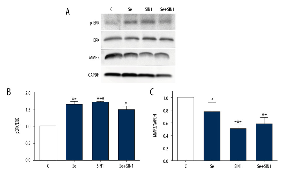 Expression of ERK and MMP2 in imDCs. Protein levels of phosphorylated ERK, ERK, and MMP2 were detected by western blot (A) and statistically analyzed with Image J software (B, C). Data are presented as mean±SD of 3 independent experiments. * P<0.05, ** P<0.01, *** P<0.001, compared with the control group.