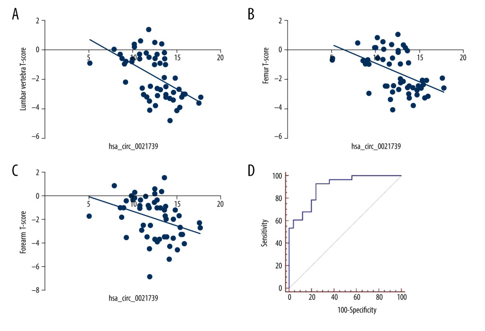 Correlation between hsa_circ_0021739 expression and clinical characteristics of patients with postmenopausal osteoporosis (PMOP). (A–C) Correlation between hsa_circ_0021739 expression and T-scores for the lumbar vertebra, femur, and forearm. (D) Receiver-operating characteristic (ROC) curve for hsa_circ_0021739 expression in peripheral blood mononuclear cells (PBMCs) of PMOP patients (area under the curve [AUC]: 0.849, confidence interval [CI]: 0.724–0.932, P<0.001).