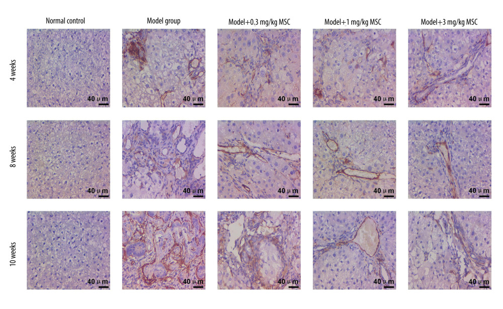 Immunohistochemical analysis evaluating the CD34 expression in liver tissues of rats in different groups. The scale bars of 200 μm are illustrated in images.