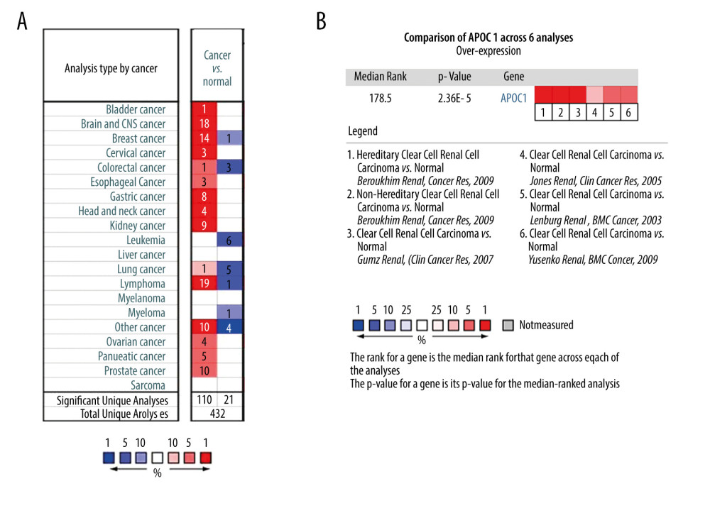 Expression of APOC1 in human cancers. (A) Disease summary for APOC1. red: high expression, blue: low expression. The threshold was set as follows: P value: 0.05, fold change: 2, gene rank: 10%, (B) Comparison of APOC1 across 6 analyses regarding ccRCC via meta-analysis. All data were derived from the Oncomine database based on TCGA data.