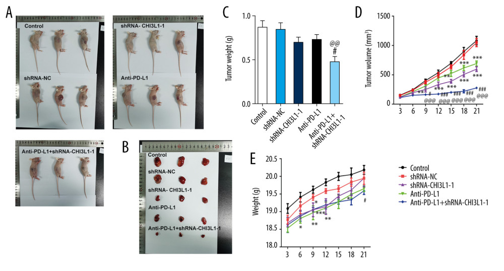 knockdown of CHI3L1 promotes the effect of anti-PD-L1 antibody in the mouse model. (A–C) Representative images, growth, and weight of tumors following subcutaneous injection of the ShRNA-NC, ShRNA-CHI3L1-1, anti-PD-L1, anti-PD-L1+ ShRNA-CHI3L1-1, or control cells. (D, E) tumor volume and weight were measured at 3,5, 7, 9, 11, 13, and 15 days after injection of ShRNA-NC, ShRNA-CHI3L1-1, anti-PD-L1, anti-PD-L1+ ShRNA-CHI3L1-1, or control cells. Data are presented as mean±SD. Results shown here are the representative of 3 independent experiments. * p<0.05, ** p<0.01, *** p<0.005 vs Control; # p<0.05, ### p<0.005 vs shRNA-CHI3L1-1; @@ p<0.01, @@@ p<0.005 vs Anti-PD-L1.