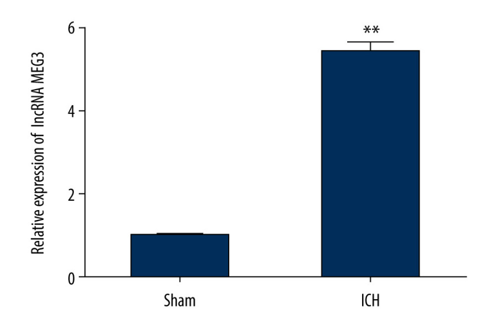 The expression level of LncRNA MEG3 in brain tissues of ICH rats. Three days after ICH induction, lncRNA MEG3 levels in brain tissues from sham and ICH rats were determined using qRT-PCR. ** P<0.01 vs sham.