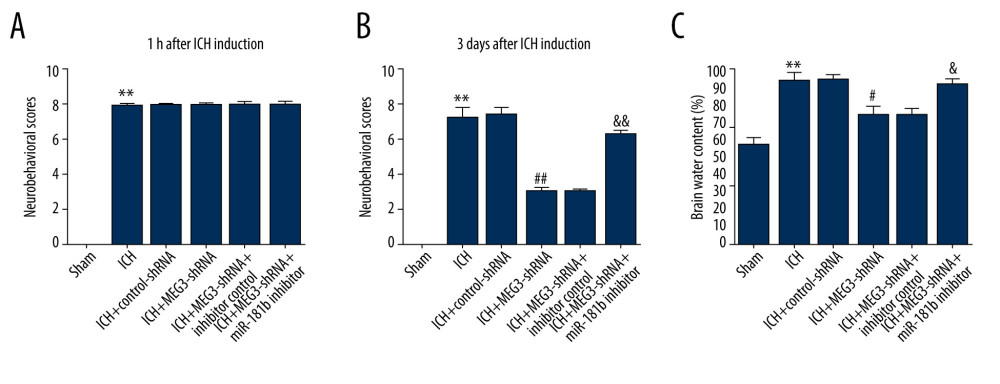 Effects of lncRNA MEG3-shRNA on neurological damage in ICH rats. After ICH induction, ICH rats were treated with control-shRNA, lncRNA MEG3-shRNA, inhibitor control, or miR-181b inhibitor. (A) At 1 hour following ICH or sham operation, the neurobehavioral scores of rats were measured by neurological severity score method. (B) The mNSS test was applied to assess neurobehavioral scores at 3 days after ICH or sham operation in different groups. (C) Three days after ICH induction, brain water contents were assessed using the wet/dry method in different groups. ** P<0.01 vs Sham; #, ## P<0.05, 0.01 vs ICH+control-shRNA; &, && P<0.05, 0.01 vs ICH+MEG3-shRNA+inhibitor control.