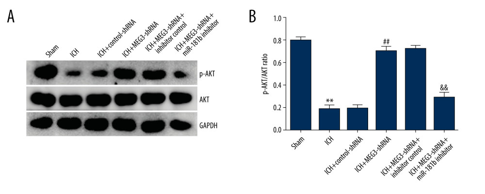 (A, B) Effect of lncRNA MEG3 on PI3K/AKT pathway in ICH rats by targeting miR-181b. One hour after ICH induction, control-shRNA, lncRNA MEG3-shRNA, inhibitor control, or miR-181b inhibitor were injected into rats. Three days after ICH induction, the protein levels of p-AKT and AKT were assessed using western blotting in different groups. The ratio of p-AKT/AKT was calculated and presented. ** P<0.01 vs sham; ## P<0.01 vs ICH+control-shRNA; && P<0.01 vs ICH+MEG3-shRNA+inhibitor control.