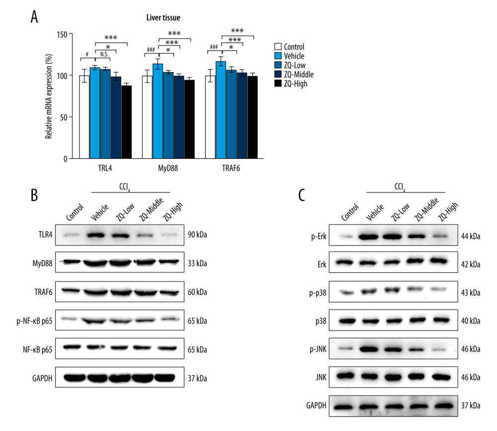 Toll-like receptor 4 (TLR4)-related nuclear factor kappa b (NF-κB) and mitogen-activated protein kinase (MAPK) signaling pathways were inhibited by Zi Qi decoction in vivo. (A) Messenger RNA expression of TLR4, MyD88, and TRAF6 in liver tissue in each group. (B) Protein expression of TLR4, MyD88, TRAF6, and phospho-NF-κB p65 in liver tissue in each group. (C) Expression of MAPK pathway-related proteins and their relative phosphorylation levels in liver tissue in each group. # P<0.05, compared with the control group. * P<0.05, *** P<0.001, compared with the vehicle group. Data were presented as means±standard deviations.
