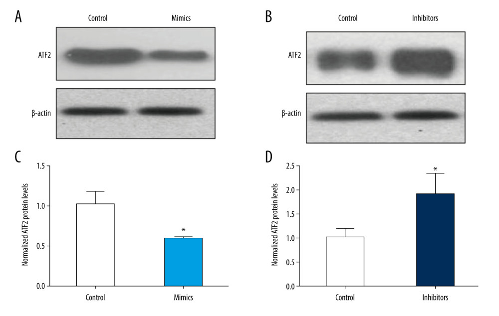 miR-451 negatively regulated protein levels of ATF2 in B-CPAP cells. Control miRNA (control), miR-451 mimics (mimics), or miR-451 inhibitor (inhibitors) were transfected into B-CPAP cells. After 48 h, the protein levels of ATF2 were detected with immunoblotting. (A, B) Representative images of immunoblotting. (C, D) Relative band intensity of the immunoblotting bands (C for A, D for B). Data are shown as the mean±SD; *P<0.05 versus the control group.