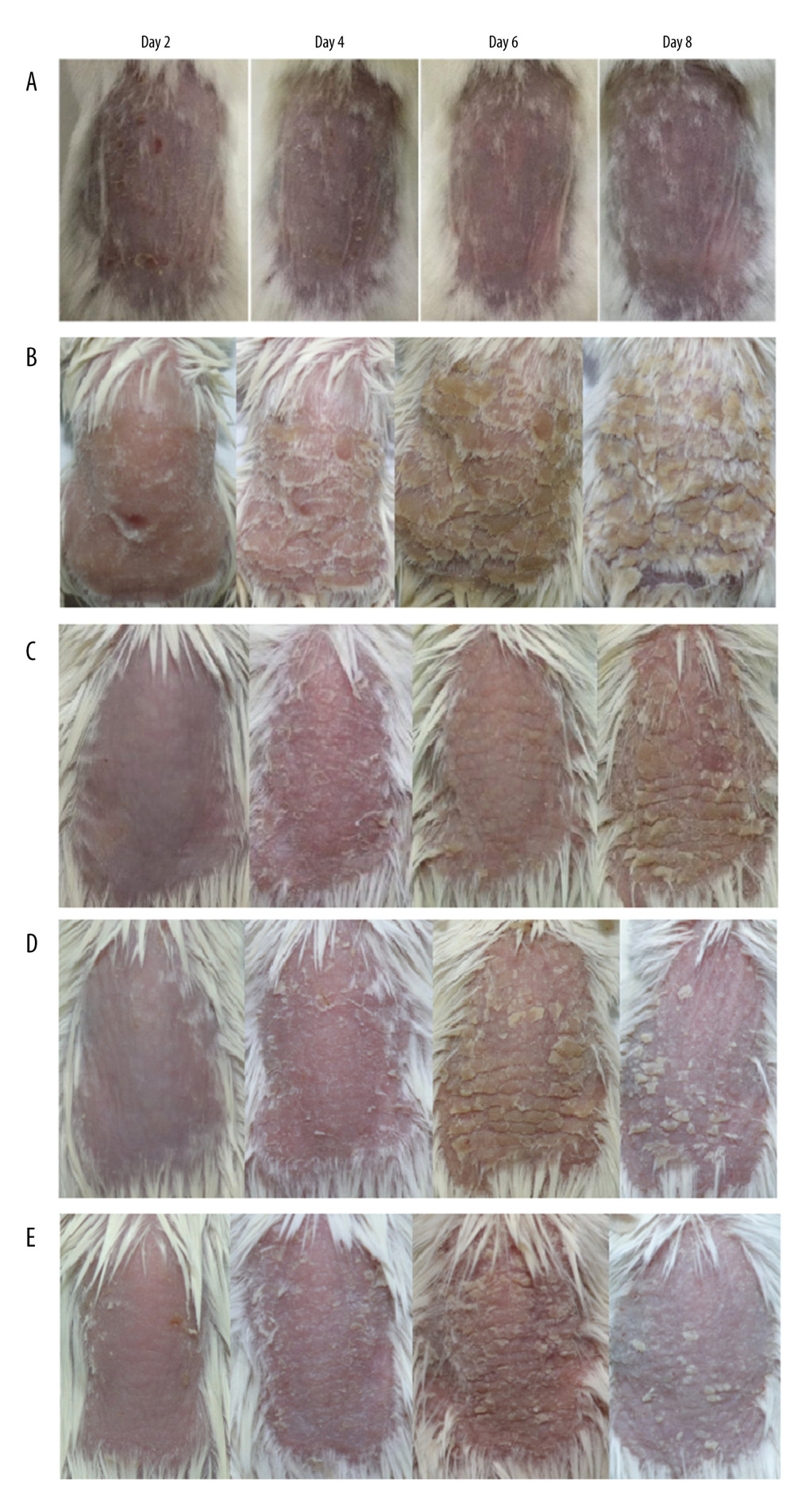 The phenotype of dorsal skin in different treatment groups observed on days 2, 4, 6, and 8. (A) Normal, (B) imiquimod (IMQ), (C) phosphate-buffered saline intramuscular injection (IM-PBS), (D) pGP3 intramuscular injection (IM-pGP3), and (E) pGP3M intramuscular injection (IM-pGP3M) groups. The IMQ, IM-PBS, IM-pGP3, and IM-pGP3M groups exhibited psoriasis-like dermatitis signs including erythema, skin scaling, and thickening after IMQ application. The typical signs of psoriasis-like dermatitis decreased after the sixth day in the IM-pGP3, and IM-pGP3M groups. Compared with the IMQ and IM-PBS groups, the IM-pGP3 and IM-pGP3M groups exhibited milder skin lesions and shorter healing time.