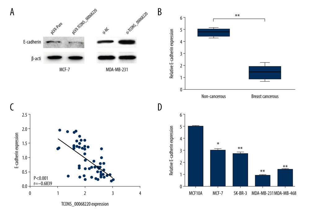 TCONS_00068220 promotes EMT and E-cadherin was downregulated in breast cancer. (A) Western blot assay was used to evaluate the protein expression of EMT markers in response to TCONS_00068220 overexpression in MCF-7 cells or knockdown in MDA-MB-231 cells. (B) E-cadherin level in breast cancer and adjacent normal tissues. (C) Negative correlation between expression levels of TCONS_00068220 and E-cadherin in breast cancer tissues. (D) E-cadherin level in MCF10A and various breast cancer cells. EMT, epithelial-mesenchymal transition. * P<0.05 and ** P<0.01 vs control.