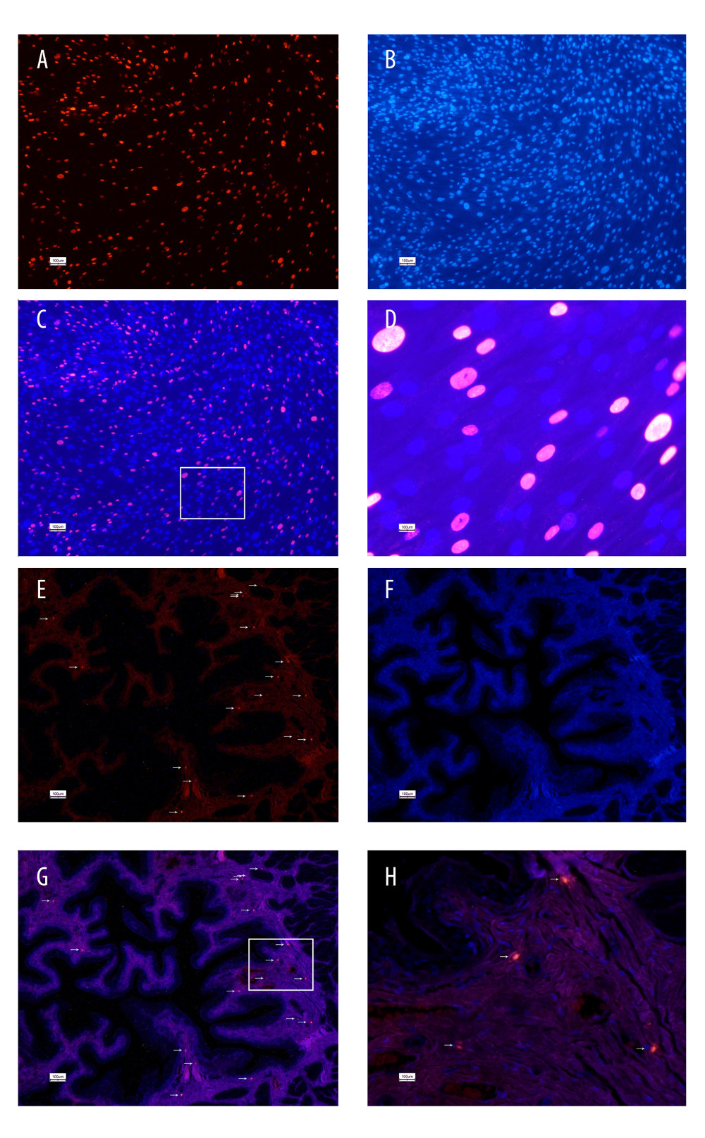 5-Ethynyl-2-deoxyuridine (EdU) labeling of UC-MSCs in vitro and tracking EdU-labeled human umbilical cord-derived mesenchymal stem cells (UC-MSCs) in vivo. UC-MSCs labeled by EdU and stained with Apollo 567 (A, red fluorescence) and Hoechst 33342 (B, blue fluorescence). EdU-labeled UC-MSCs stained with Apollo 567 in harvested rat bladders (E, red fluorescence), Hoechst 33342 (F, blue fluorescence). The boxed areas in the ×40 magnified images in (C) and (G) were amplified ×200 in the corresponding (D) and (H), respectively. White arrows point to nuclei that are presented in the graphs.