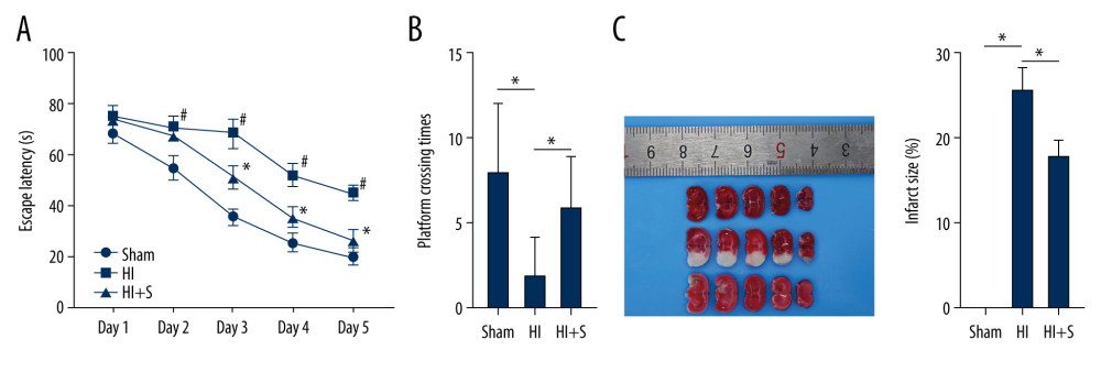 Sevoflurane post-treatment attenuates cognitive impairment in HIBI neonatal rats. (A) Escape latency of rats in each group assessed by Morris water maze test, N=18, # P<0.001, Sham group vs HI group; * P<0.001, HI group vs HI+S group. (B) The platform crossing times of rats in each group measured by spatial probe test, N=18. (C) The cerebral infarct size in rats of each group measured by TTC staining, N=6. The data are expressed as the mean±standard deviation. The data between groups were analyzed by one-way ANOVA, followed by Tukey’s multiple comparisons test. * P<0.05.