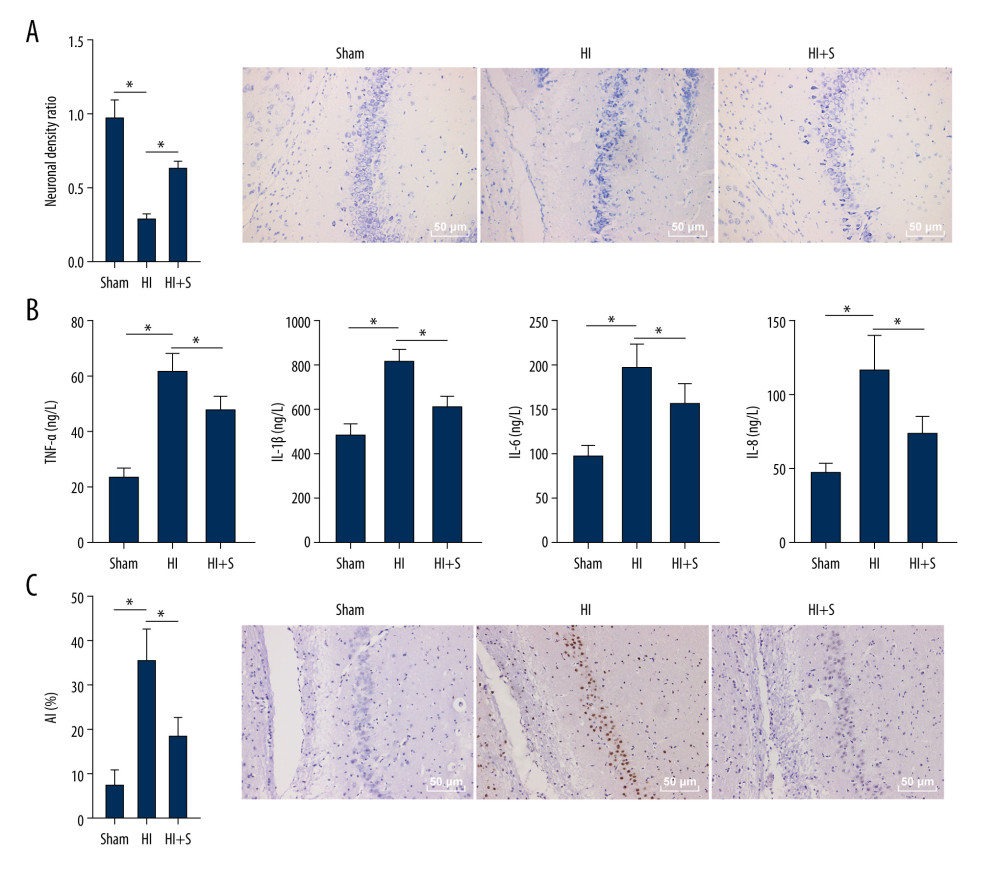 Sevoflurane post-treatment relieves inflammation and nerve cell apoptosis in HIBI neonatal rats. (A) Nissl staining was performed on the hippocampus of rat brain tissues in each group, and we compared the neuronal density ratios. (B) ELISA was used to measure the levels of inflammatory factors (TNF-α, IL-1β, IL-6, and IL-8) in rats of each group. (C) TUNEL staining was carried out to observe nerve cell apoptosis in brain tissues of rats in each group. N=6. The data are expressed as the mean±standard deviation. The data among groups were analyzed by one-way ANOVA, followed by Tukey’s multiple comparisons test. * P<0.05.