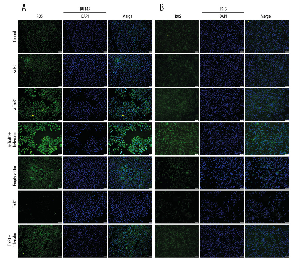 Helenalin exposure promotes ROS generation by suppression of TrxR1 in prostate carcinoma cells. (A, B) The ROS levels were examined for 2 prostate carcinoma cells exposed to si-TrxR1, TrxR1 plasmid, and/or helenalin by DCFH-DA staining. Bar=50 μM.