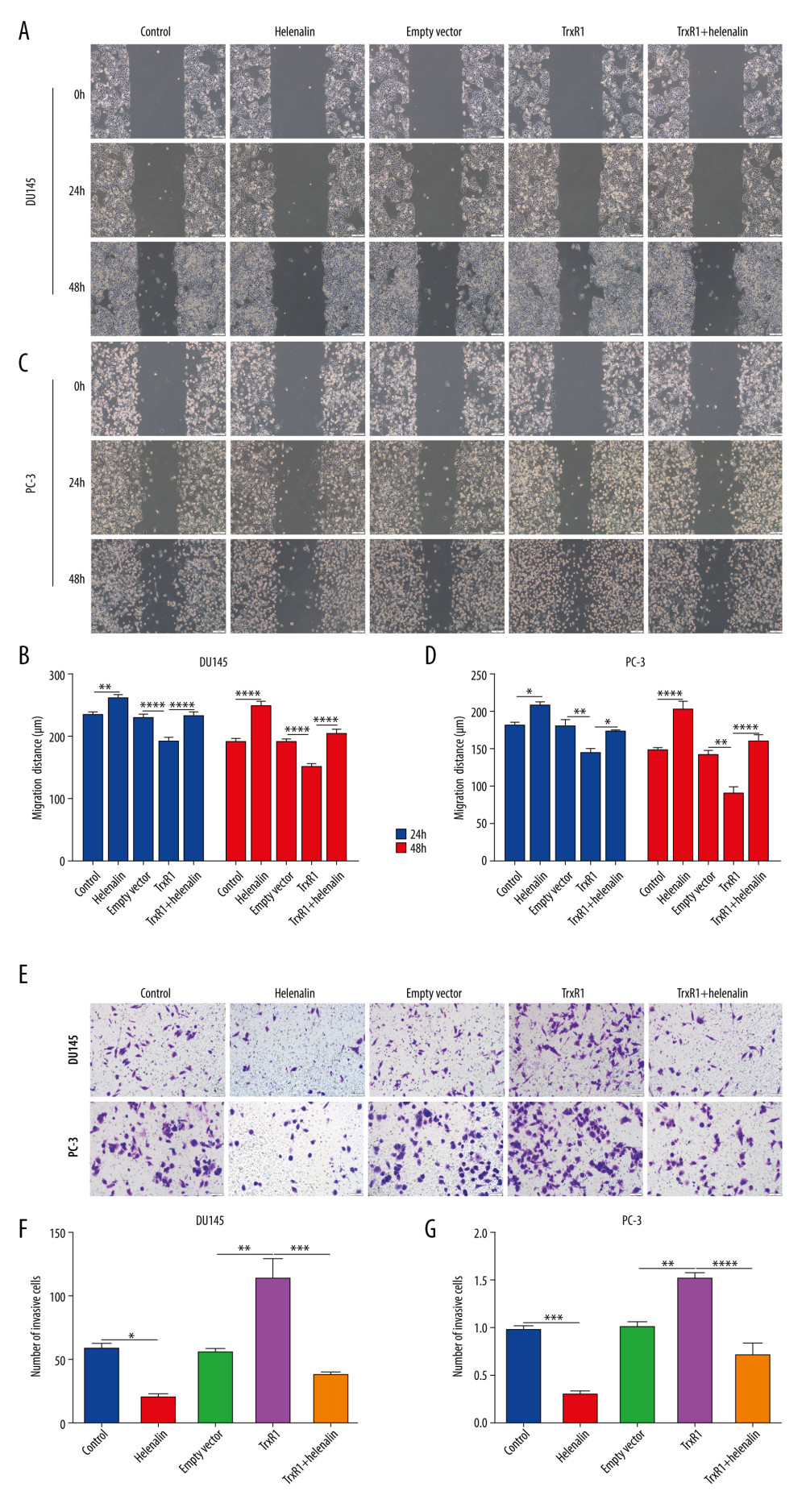 Helenalin suppresses migration and invasion by TrxR1 expression in prostate carcinoma cells. (A–D) Migration distance was detected in (A, B) DU145 and (C, D) PC-3 cells treated with TrxR1 plasmid and/or helenalin by wound healing assay. (E–G) The number of invasive DU145 and PC-3 cells was assessed following treatment with TrxR1 plasmid and/or helenalin by transwell assay. * P<0.05; ** P<0.01, *** P<0.001; **** P<0.0001.