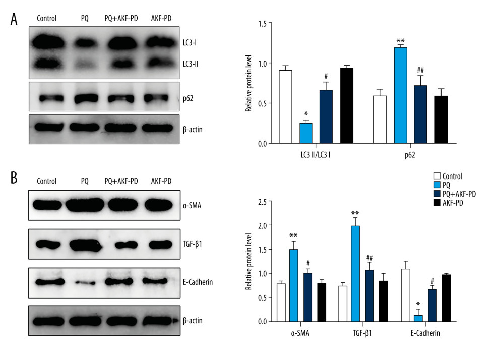 Fluorofenidone attenuated pulmonary fibrosis by upregulating autophagy. (A), Effects of fluorofenidone on the expression of fibrosis-related proteins in rat lung tissue. (B), Effects of fluorofenidone on the expression of autophagy-related proteins in rat lung tissue. * P<0.05 vs the control group; ** P<0.01 vs the control group; # P<0.05 vs the PQ group.