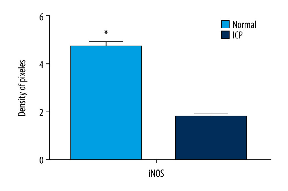 Quantitative data concerning inducible nitric oxide synthase (iNOS) in placental tissues. iNOS immunostaining as indicated by integral optical density/area of the target region (IOD/area). The mean value was significantly different from that of cholestasis of pregnancy (ICP) group (* P<0.05).