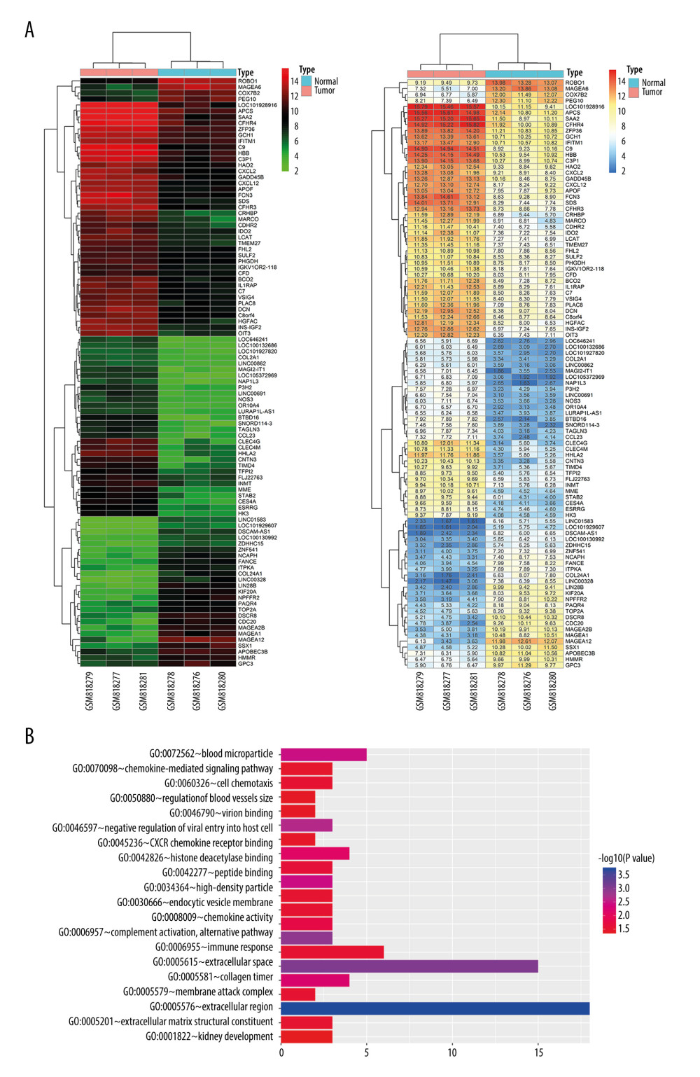 Bioinformatic analysis of HHLA2 expression in hepatocellular carcinoma. (A) Heat map of genes differentially expressed between cancer and normal tissue from the data set GSE33006. (B) Gene ontology analysis of genes from panel A.