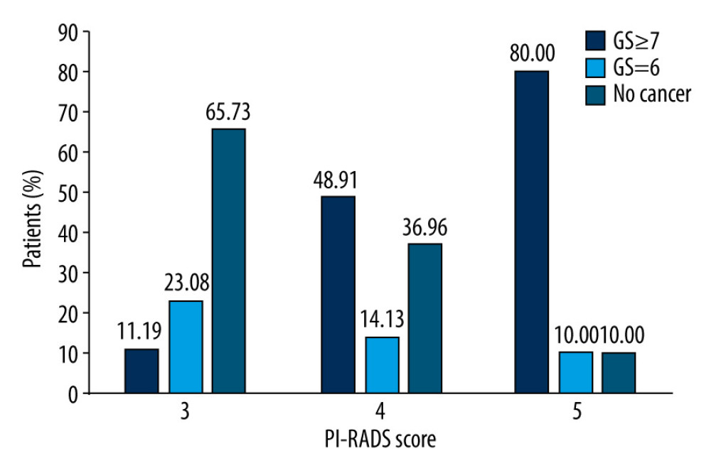 Diagnostic performance of Prostate Imaging Recording and Data System (PI-RADS) version 2.0 involving 218 men with 265 suspicious lesions. Of the 265 suspicious lesions, 143 (53.96%) had a PI-RADS v2 score of 3, 92 (34.71%) had a score of 4, and 30 (11.32%) had a score of 5. The positive detection rates for csPCa in patients with PI-RADS scores of 3, 4, and 5, were 11.19%, 48.91%, and 80.00%, respectively. GS – Gleason score.