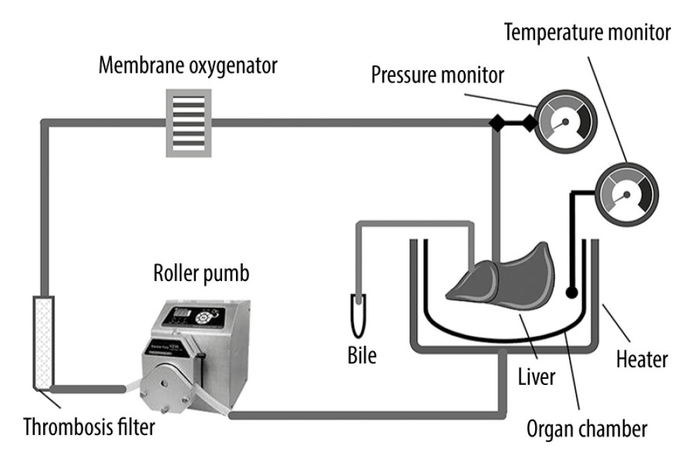 Schematic diagram of the NMP system. The NMP system is a single-cycle system that mainly includes centrifugal pumps, membrane oxygenators, organ chambers, heaters, and pressure and temperature monitors. NMP – normothermic machine perfusion.