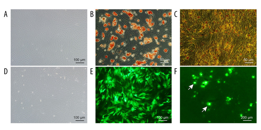 Evaluation of the NMP system and BMMSCs. (A) Morphology characteristics of third-generation BMMSCs; (B) Adipogenic induction; (C) Osteogenic induction; (D) Bright-field image of GFP-BMMSCs; (E) Fluorescent image of GFP-BMMSCs showing that >85% of the cells are transduced with GFP; (F) Fluorescent image of DCD donor liver perfused by BMMSCs combined with NMP at 6 h, the arrow indicates GFP-BMMSCs colonized in hepatic sinusoids. BMMSCs – bone marrow mesenchymal stem cells; GFP – green fluorescent protein; NMP – normothermic machine perfusion.