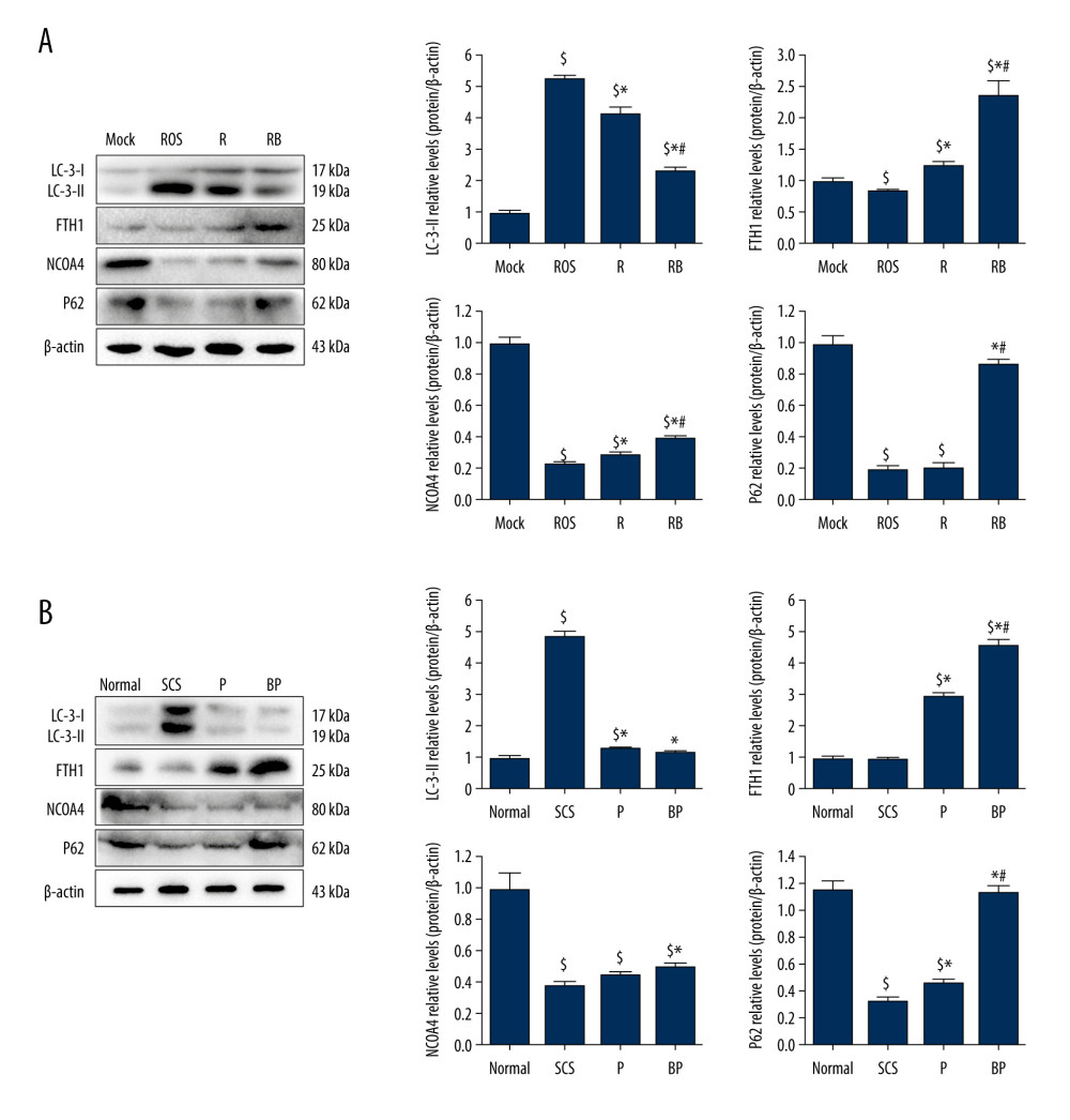 Decreased autophagy and increased expression of ferritinophagy-related proteins in IAR-20 cells co-cultured with BMMSCs. (A) Western blot of LC-3, FTH1, NCOA4 and P62 in IAR-20 cells of different groups. Expression level of LC-3-II in the RB group was significantly lower than that in the R group and ROS group (ROS group vs Mock group, P<0.001; R group vs Mock group, P<0.001; R group vs ROS group, P=0.005; RB group vs Mock group, P<0.001; RB group vs ROS group, P<0.001; RB group vs R group, P=0.001). Expression level of FTH1 in the RB group was significantly higher than that in the R group and ROS group (ROS group vs Mock group, P=0.040; R group vs Mock group, P=0.014; R group vs ROS group, P=0.003; RB group vs Mock group, P=0.003; RB group vs ROS group, P=0.002; RB group vs R group, P=0.005). Expression level of NCOA4 in the RB group was significantly lower than that in the R group and ROS group (ROS group vs Mock group, P<0.001; R group vs Mock group, P<0.001; R group vs ROS group, P=0.013; RB group vs Mock group, P<0.001; RB group vs ROS group, P<0.001; RB group vs R group, P=0.002). Expression level of P62 in the RB group was significantly lower than that in the R group and ROS group (ROS group vs Mock group, P<0.001; R group vs Mock group, P<0.001; R group vs ROS group, P=0.863; RB group vs Mock group, P=0.081; RB group vs ROS group, P<0.001; RB group vs R group, P<0.001). $ P<0.05 vs the Mock group, * P<0.05 vs the ROS group, # P<0.05 vs the R group. (B) Western blot of LC-3, FTH1, NCOA4 and P62 in liver tissues of different groups. Expression level of LC-3-II in the BP group was significantly lower than that in the SCS group (SCS group vs Normal group, P<0.001; P group vs Normal group, P=0.017; P group vs SCS group, P<0.001; BP group vs Normal group, P=0.124; BP group vs SCS group, P<0.001; BP group vs P group, P=0.172). Expression level of FTH1 in the BP group was significantly higher than that in the P group and SCS group (SCS group vs Normal group, P=0.602; P group vs Normal group, P<0.001; P group vs SCS group, P<0.001; BP group vs Normal group, P<0.001; BP group vs SCS group, P<0.001; BP group vs P group, P=0.001). Expression level of NCOA4 in the BP group was significantly higher than that in the SCS group (SCS group vs Normal group, P<0.001; P group vs Normal group, P<0.001; P group vs SCS group, P=0.054; BP group vs Normal group, P<0.001; BP group vs SCS group, P=0.004; BP group vs P group, P=0.055). Expression level of P62 in the BP group was significantly higher than that in the P group and SCS group (SCS group vs Normal group, P<0.001; P group vs Normal group, P<0.001; P group vs SCS group, P=0.005; BP group vs Normal group, P=0.062; BP group vs SCS group, P<0.001; BP group vs P group, P<0.001). $ P<0.05 vs the Normal group, * P<0.05 vs the SCS group, # P<0.05 vs the P group. SCS – static cold storage; P – NMP; BP – BMMSCs combined with NMP; NMP – normothermic machine perfusion; BMMSCs – bone marrow mesenchymal stem cells; ROS – reactive oxygen species; LC-3 – light Chain 3; FTH1 – ferritin heavy chain; NCOA4 – nuclear receptor co-activator 4; P62 – sequestosome 1/p62.