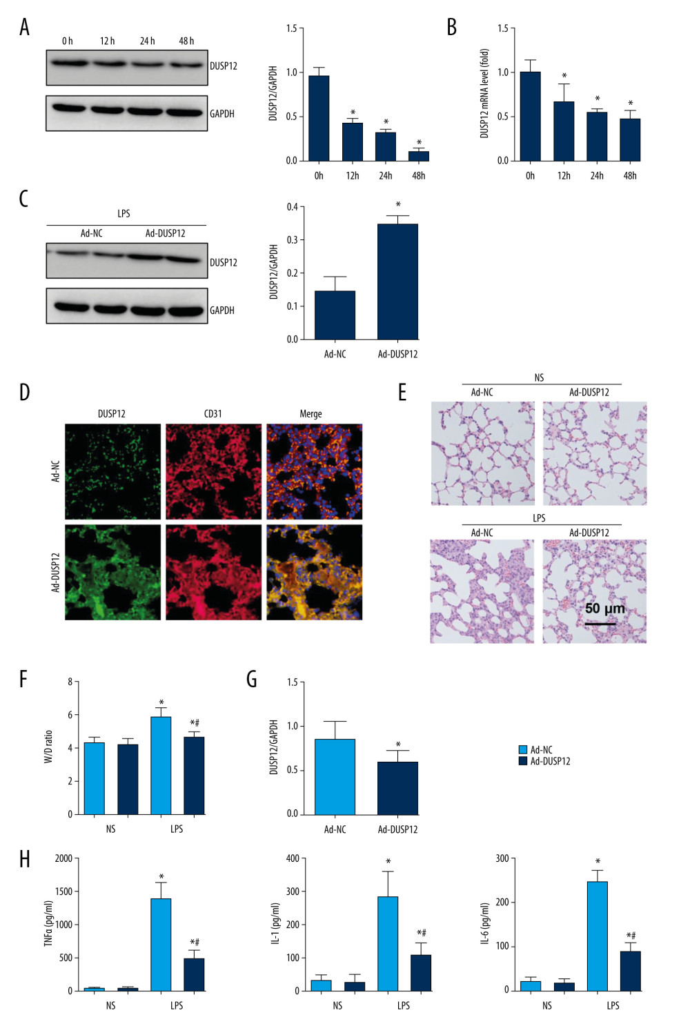 DUSP12 suppressed LPS-induced lung injury in mice. (A, B) DUSP12 protein and mRNA levels in lung tissue after treatment with lipopolysaccharide (LPS) (* P<0.05 vs 0 h). (C) Protein level of DUSP12 in mouse lung tissue 42 h after Ad-DUSP12 injection (n=6). (D) Immunofluorescence staining of CD31 and DUSP12 after Ad-DUSP12 injection (n=5, magnification: 400). (E) Hematoxylin and eosin (H&E) staining (n=5, magnification: 200). (F) Lung wet weight/dry weight ratio (W/D ratio) (n=10). (G) Lung injury score (n=6). (H) Proinflammatory factor levels in alveolar lavage fluid as measured by ELISA (n=6). (* P<0.05 vs Ad-NC/NS; # P<0.05 vs Ad-NC/LPS).