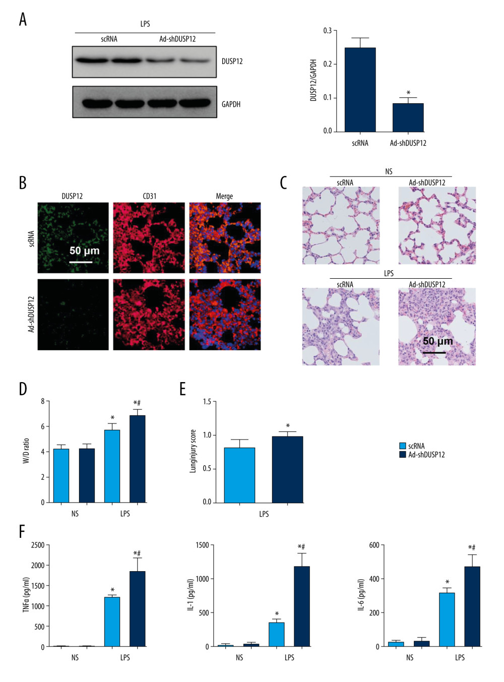 DUSP12 knockdown aggravated LPS-induced lung injury in mice. (A) Protein level of DUSP12 in mouse lung tissue 42 h after Ad-shDUSP12 injection (n=6). (B) Immunofluorescence staining of CD31 and DUSP12 after Ad-shDUSP12 injection (n=5, magnification: 400). (C) H&E staining (n=5, magnification: 200). (D) Lung wet weight/dry weight ratio (W/D ratio) (n=10). (E) Lung injury score (n=6). (F) Proinflammatory factor levels in alveolar lavage fluid as measured by ELISA (n=6) (* P<0.05 vs ScRNA/NS; # P<0.05 vs ScRNA/LPS).