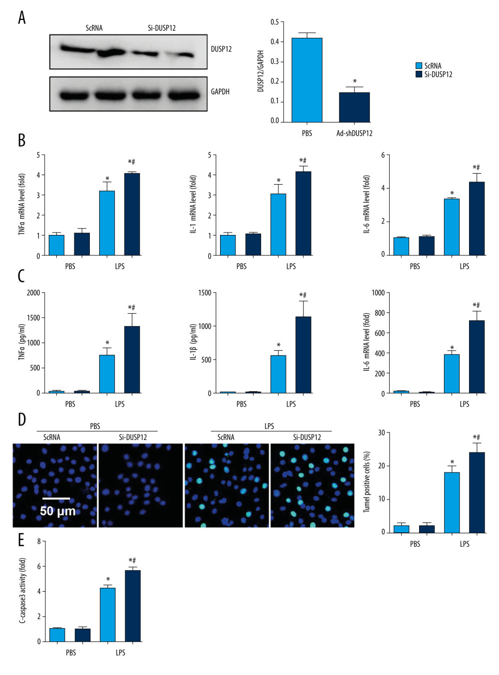 DUSP12 silencing worsened LPS-induced pulmonary endothelial cell injury. (A–E) MLECs were transfected with DUSP12 siRNA and treated with LPS. (A) Protein level of DUSP12 in MLECs transfected with siDUSP12. (B) mRNA levels of proinflammatory factors. (C) ELISA measurement of proinflammatory factors. (D) TUNEL staining (magnification: 200). (E) Caspase-3 activity (* P<0.05 vs ScRNA/PBS; # P<0.05 vs ScRNA/LPS). All in vitro studies were repeated 3 times independently.