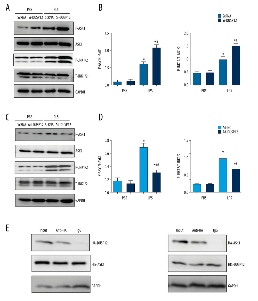 DUSP12 affected ASK1-JNK signaling. (A, B) MLECs were transfected with DUSP12 siRNA and treated with LPS. (A, B) Protein levels of P-ASK1, JNK1/2, T-ASK1, and T-JNK1/2 in MLECs transfected with siDUSP12 (* P<0.05 vs ScRNA/PBS; # P<0.05 vs ScRNA/LPS). (C, D) MLECs were transfected with Ad-DUSP12 and treated with LPS. A and B. Protein levels of P-ASK1, JNK1/2, T-ASK1, and T-JNK1/2 in MLECs transfected with AdDUSP12 (* P<0.05 vs Ad-NC/PBS; # P<0.05 vs Ad-NC/LPS). (E) Co-IP analysis of DUSP12 and ASK1 in MLECs. All in vitro studies were repeated 3 times independently.