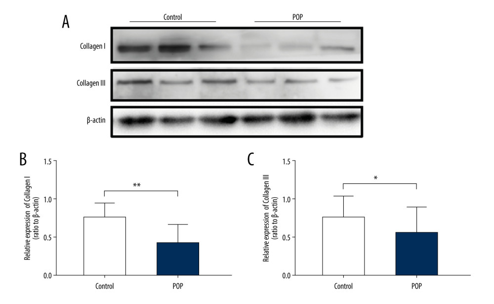 Western blot for collagen I and collagen III in the cardinal ligament. (A) Western blot analysis of collagen I and collagen III expression. (B, C) Relative densitometry analysis. * P<0.05, ** P<0.01.