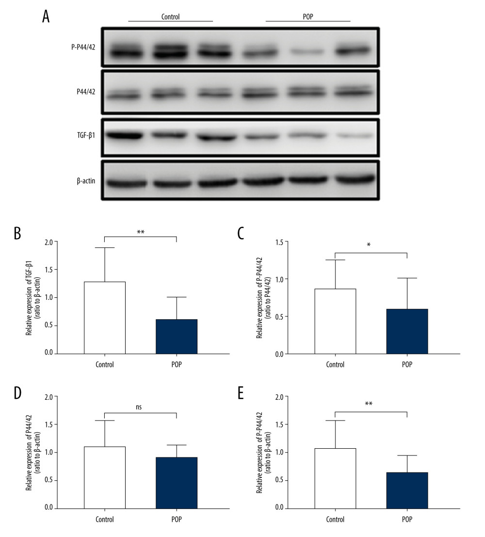 Western blot for TGF-β1, P44/42, and phospho-p44/42 in the cardinal ligament. (A) Western blot analysis of TGF-β1, P44/42, and phospho-p44/42 expression. (B–E) Relative densitometry analysis. * P<0.05; ** P<0.01; ns – non-significant.