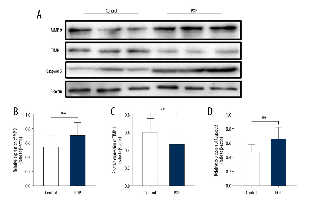 Western blot for MMP9, TIMP1, and caspase 3 in the cardinal ligament. (A) Western blot analysis of MMP9, TIMP1, and caspase 3 expression. (B–D) Relative densitometry analysis. * P<0.05, **P<0.01.