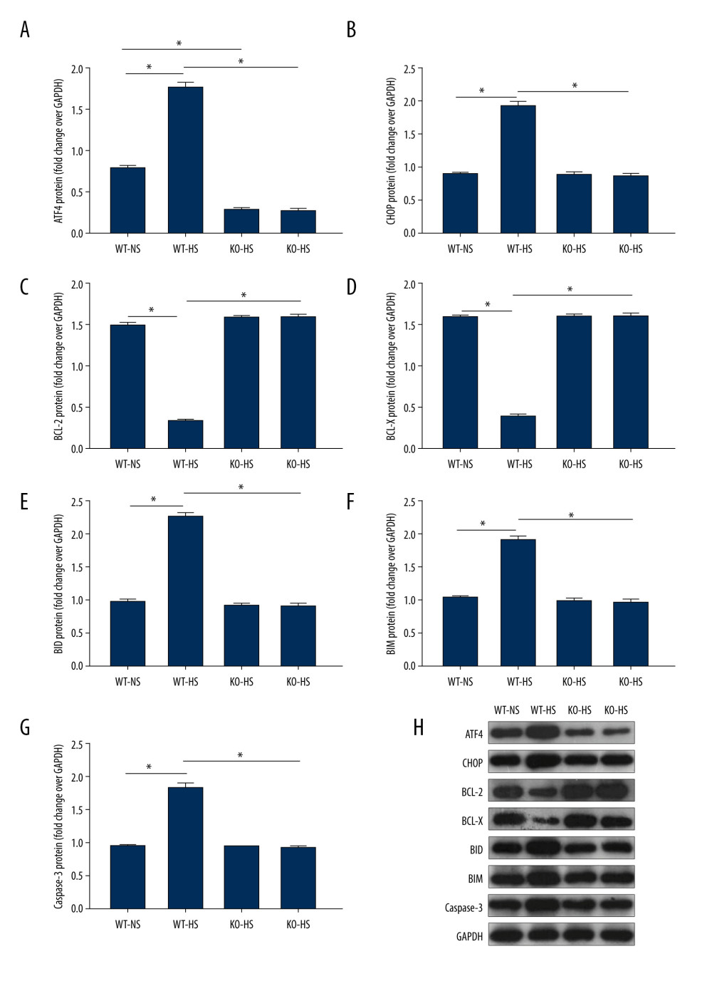 The proteins expression of endoplasmic reticulum stress and apoptosis-related genes in of activating transcription factor 4 (ATF4) knockout mice induced by high salt. (A–G) ATF4, C/EBP-homologous protein (CHOP), BCL-2, BCL-X, BH3-interacting domain death agonist (BID), Bcl-2-like protein 11 (BIM), caspase-3 protein expression. (H) Western blotting of indicated proteins. WT-NS – wild-type+normal salt group; WT-HS – wild-type+high salt group; KO-NS – ATF4+/−+normal salt group; KO-HS – ATF4+/−+high salt group. * P<0.05.