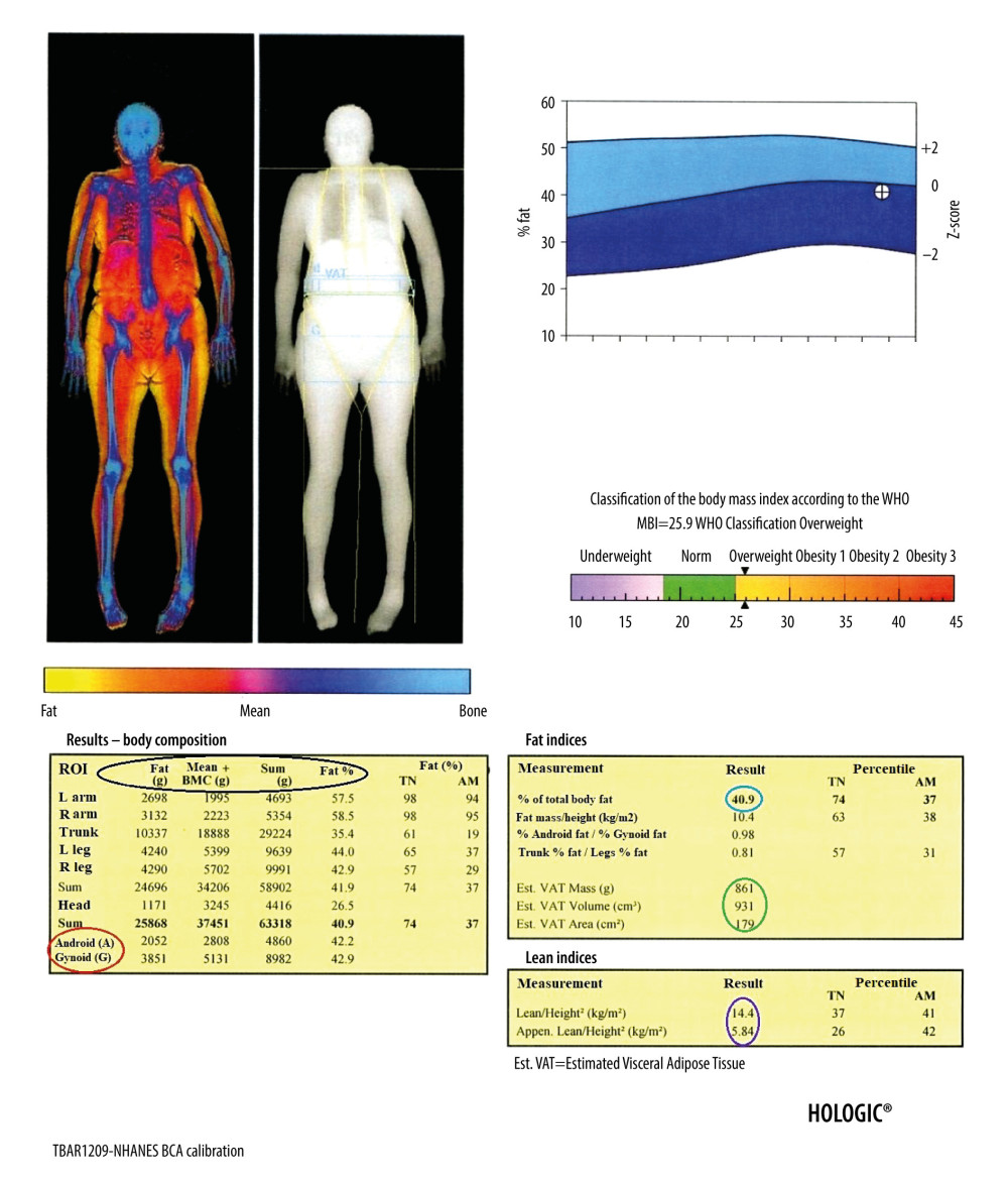 Result of the body composition assessment – soft tissues. The table on the left shows (parameters from the left, marked in the black circle, respectively): the mass of adipose tissue, the sum of the mass of other soft tissues and bone tissue, the total mass, and the percentage of fat tissue in individual ROIs, including the android and gynoid region (A and G in red circle, respectively). In the tables on the right are presented, among others: percentage of total body fat mass (blue circle), parameters of visceral adipose tissue (green circle), and parameters useful in the assessment of loss of muscle mass (purple circle).