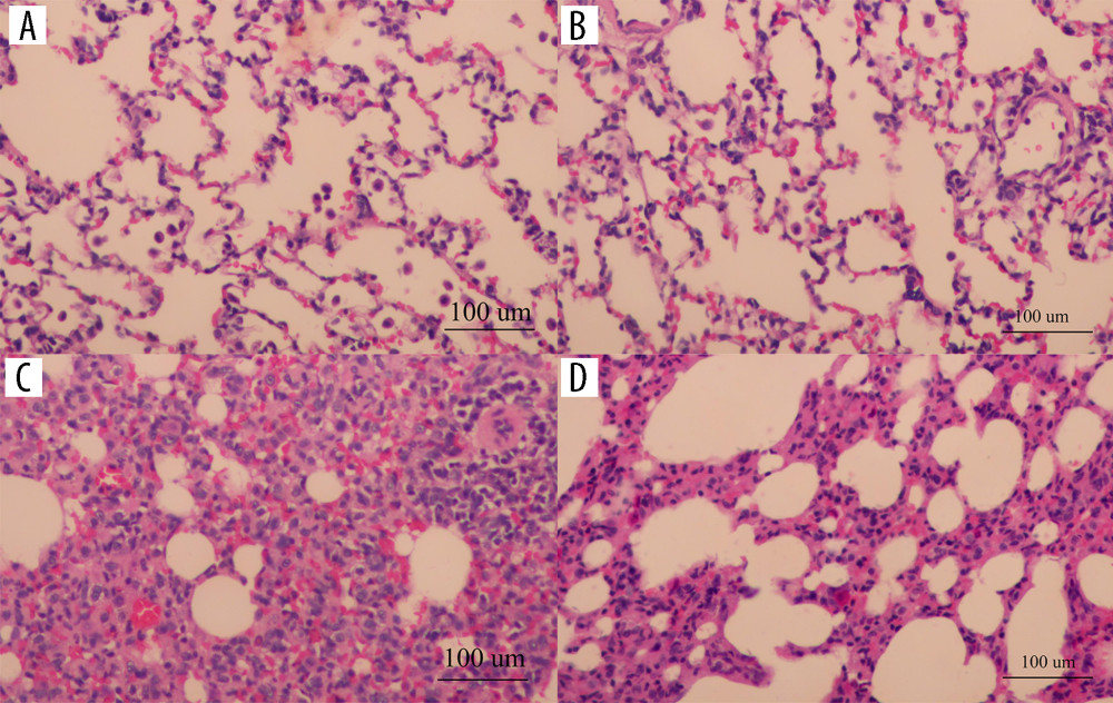 The pathological sections of rat lung tissues under light microscopic in each group (HE staining, 200×): the blank control group (A), the saline group (B), the PM2.5 exposure group (C), the erdosteine intervention group (D) (Adobe Illustrator CC 2019, Adobe Systems Incorporated).