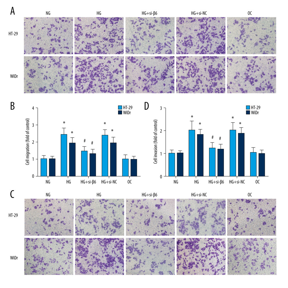 High glucose induced colon cancer cells migration and invasion through integrin αvβ6. HT-29 and WiDr cells were transfected with β6 siRNA (si-β6) or negative control (si-NC) for 24 h. Cell migration (A, B) and cells invasion (C, D) ability was measured with Transwell assay. * P<0.05 vs NG. # P<0.05 vs HG.