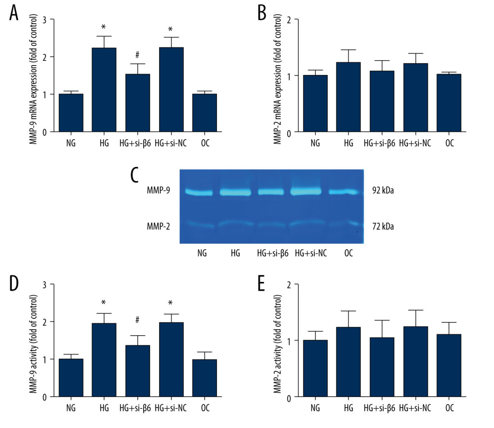 High glucose increased mRNA expression and activity of MMP-9. HT-29 cells were transfected with β6 siRNA or negative control for 24 h, and cells were incubated in normal glucose, high-glucose, or osmotic control medium. (A, B) mRNA expression of metalloproteinase-9 (MMP-9) and metalloproteinase-2 (MMP-2) was measured by real-time PCR. (C–E) Cell supernatant was collected, and the activity of MMP-9 and MMP-2 was determined by gelatin zymography. * P<0.05 vs NG. # P<0.05 vs HG.