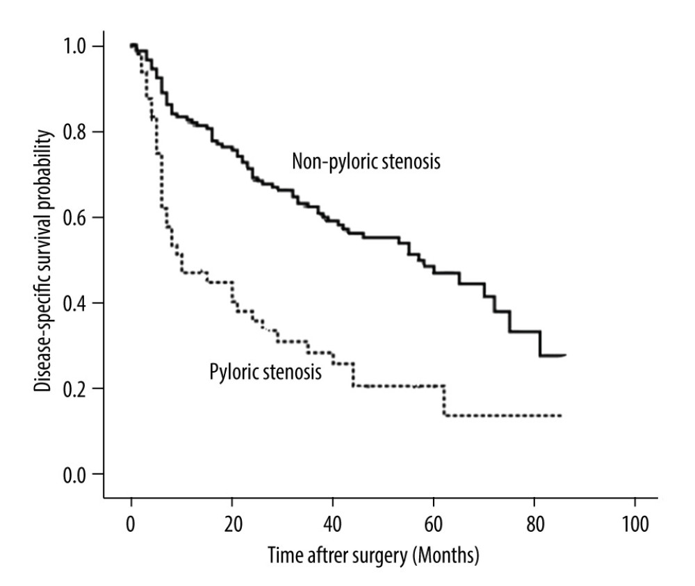 Disease-free survival curves for all patients with or without pyloric stenosis (P<0.001).